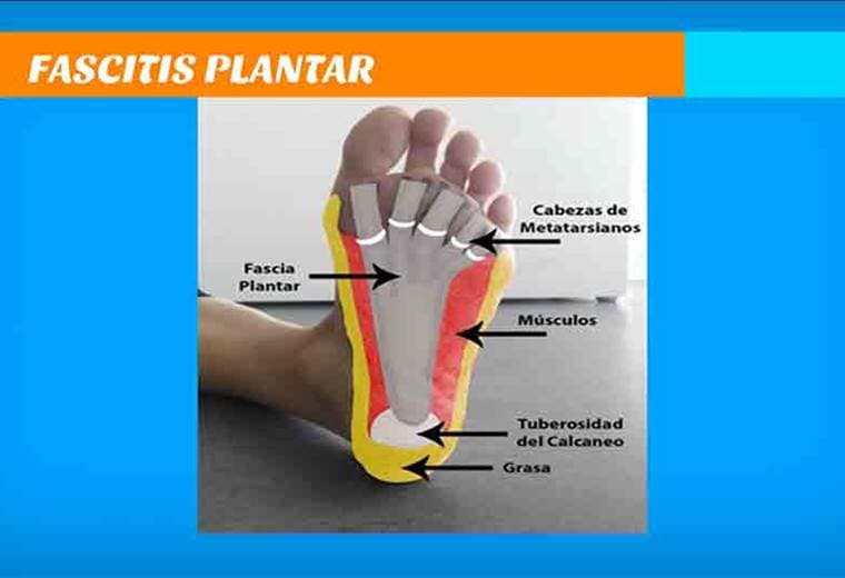 ¿Cómo tratar el dolor en el talón y la planta del pie?