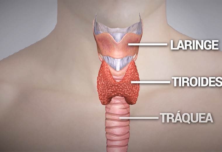 ¿Qué es la tiroiditis de Hashimoto?