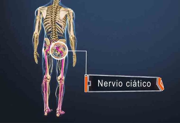 ¿qué Es El Nervio Ciático Teleticaemk 6255