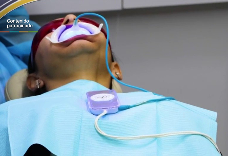 Beneficios y cuidados del blanqueamiento dental