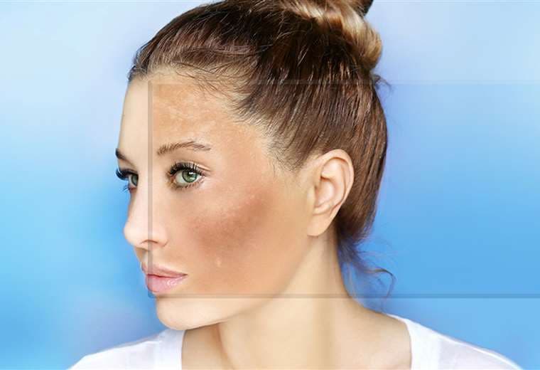 Claves para prevenir las manchas en el rostro