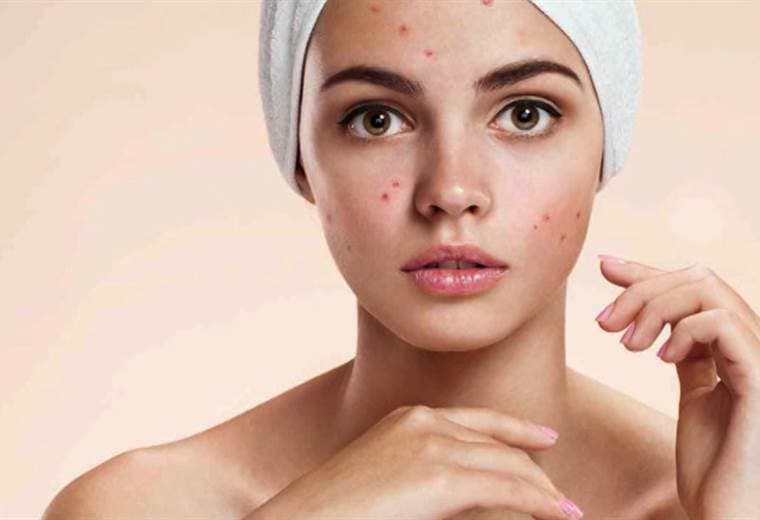 ¿Cómo saber que tengo un trastorno hormonal?