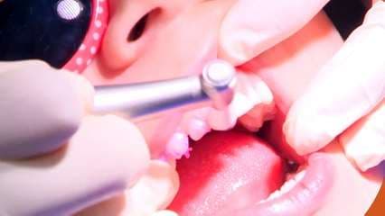 Alternativa de corona dental para niños