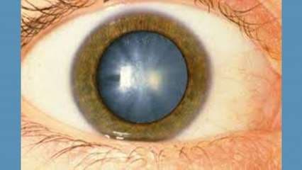 Enfermedades en los ojos producidas por la diabetes