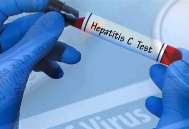 Hepatitis B y C complicaciones