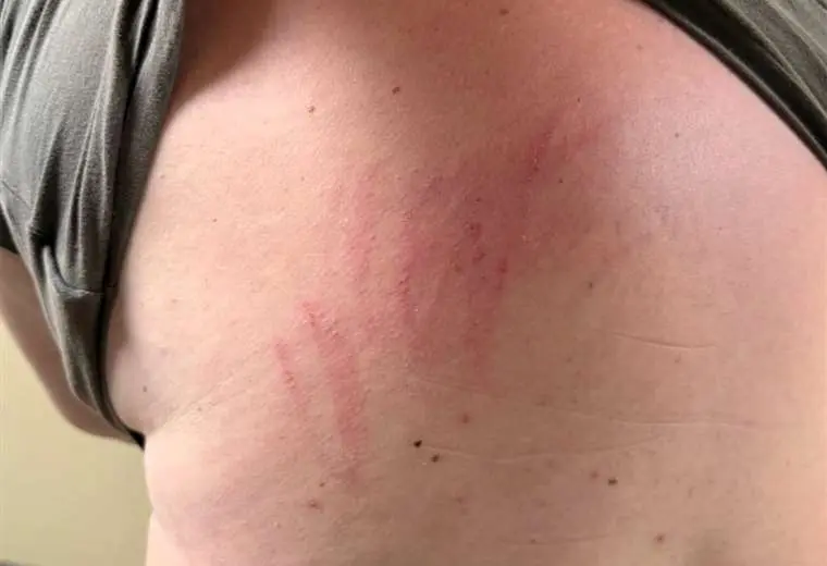 Video: Denuncian a enfermera por supuesta agresión en clínica de San José